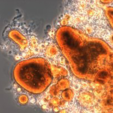 yağ sökücü bakteri